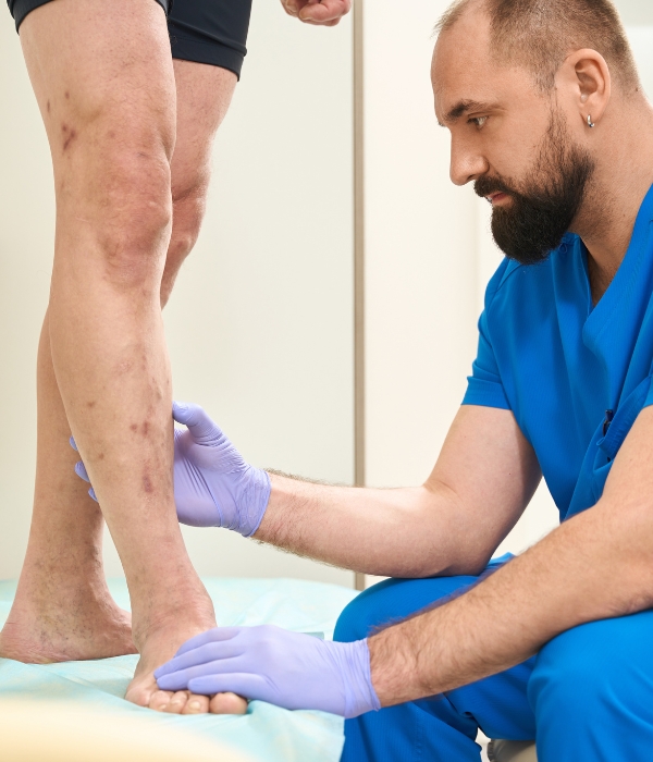 Vein clinic technician examining patient's leg